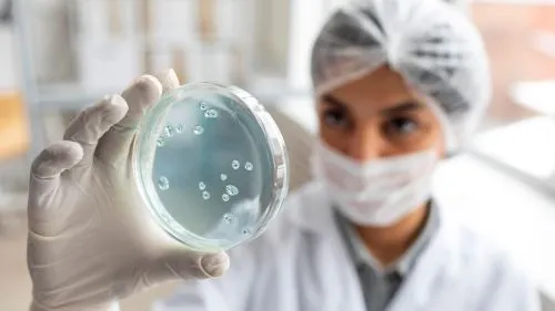 Stabilitatea microbiologică a lactatelor proaspete: tendințe și date europene 2024–2025